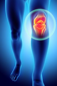 knee pain Physio