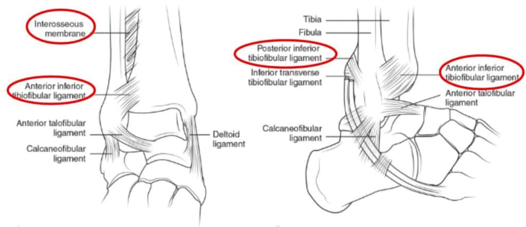 Ankle Syndesmosis Burnside Physio Physio Near Me Core Physio